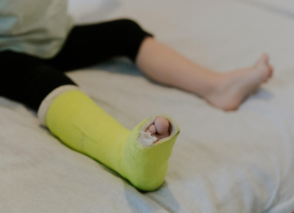Stress Fractures
