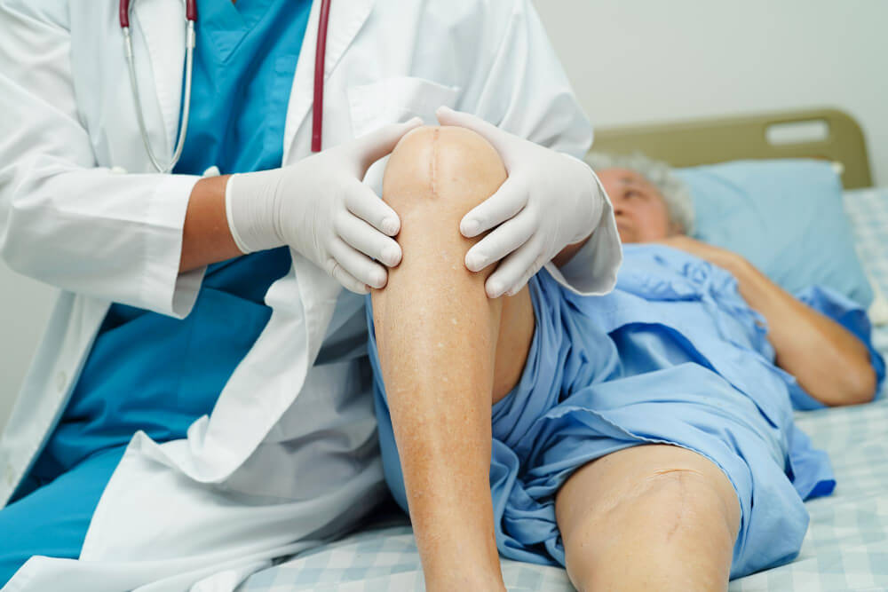 Knee Arthroscopy